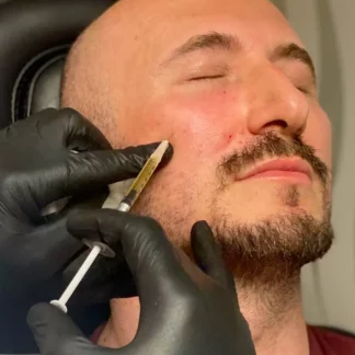 A man getting his face shaved by an esthetician.