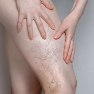 A person with very large legs and hands on their knee.