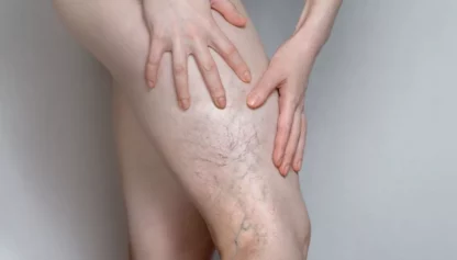 A person with very large legs and hands on their knee.